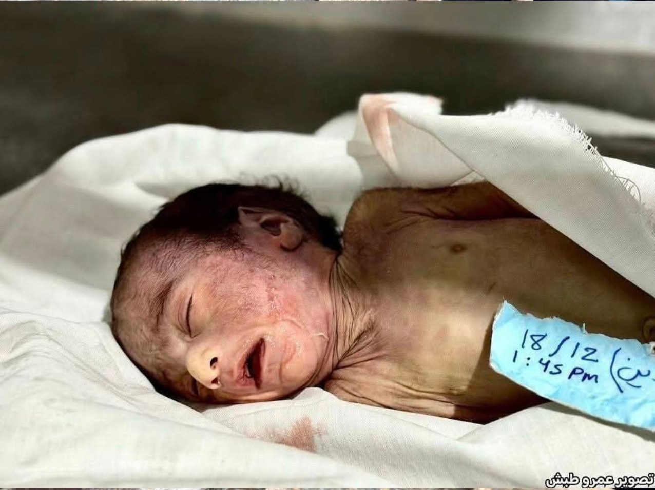 نوار غزه , کشور فلسطین , سیل , سیل زده , طوفان الاقصی , آوارگان , 