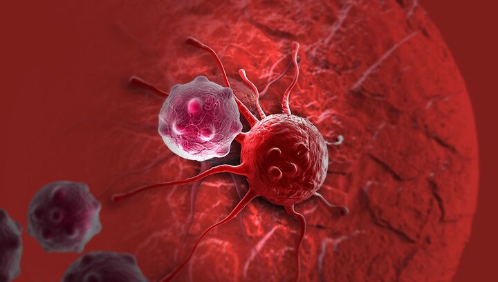 سرطان پستان در ایران رو به افزایش است