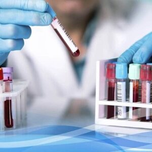 اعتماد اتحادیه اروپا به آزمایشگاه‌های مرجع ایران