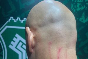 جراحت مربی دروازه‌بان‌های استقلال در پایان بازی با خیبر