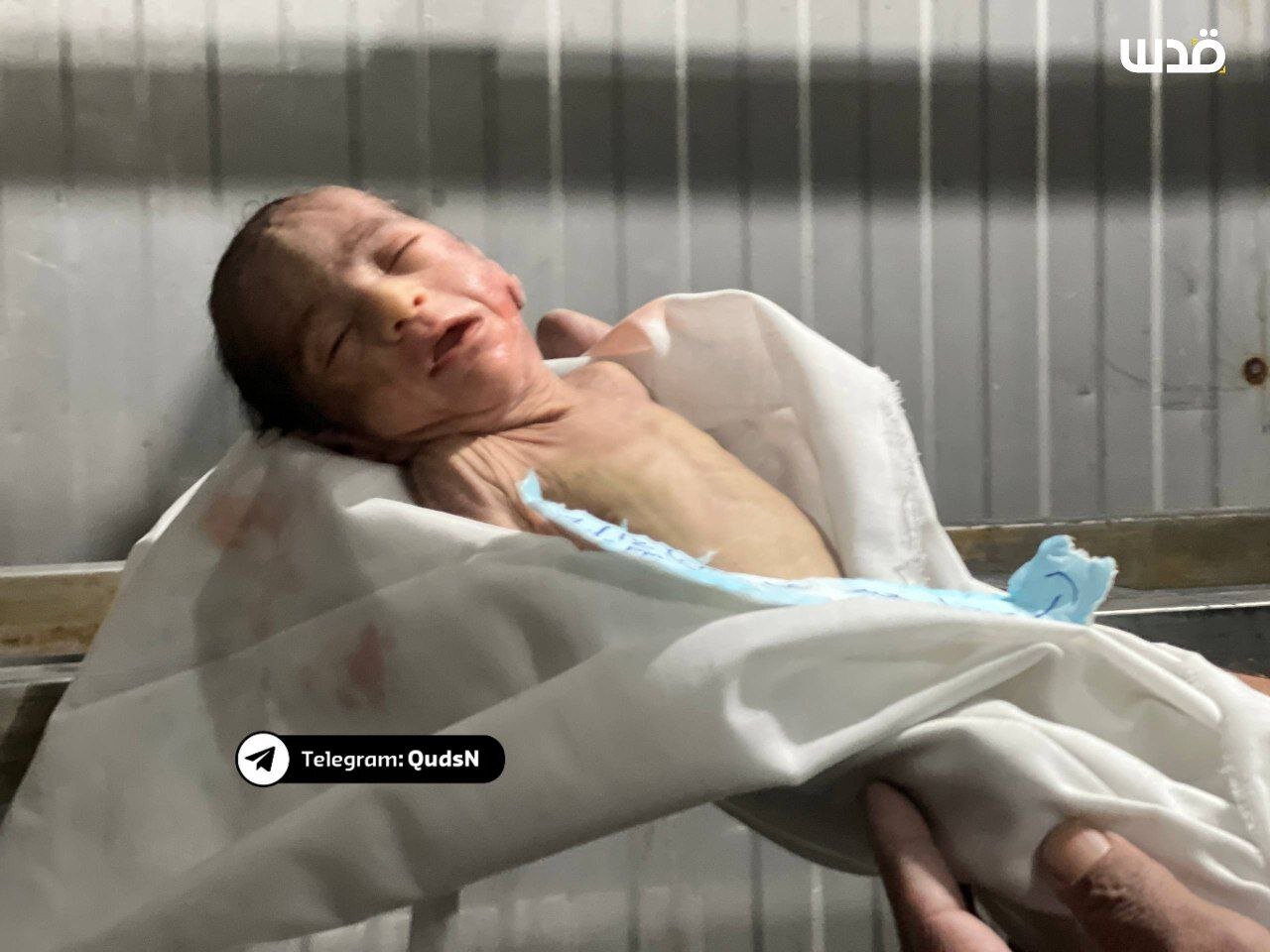 شهادت نوزاد یک ماهه در نوار غزه بهعلت سرمای شدید+ عکس