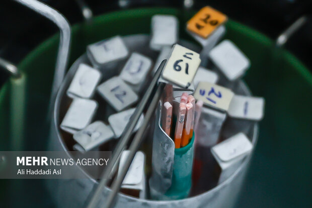 هر کیت برای یک نفر است و برای انجماد و نگهداری آن در ایران مبلغ بسیار اندکی دریافت می شود